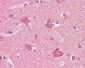 PRKAR2B Antibody (aa79-128)